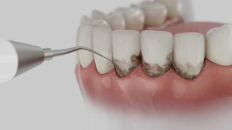 Trusted Dental Implants service in St. Ann, MO - Dentist Open Now